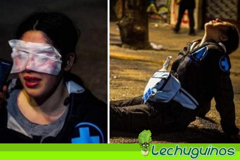 Profesora chilena sufre ceguera temporal por ataque de Carabineros